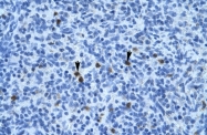 ARP36578_T100 - Annexin A3 / ANXA3