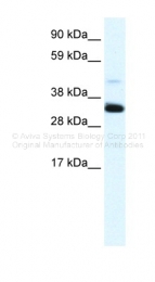 ARP36578_T100 - Annexin A3 / ANXA3