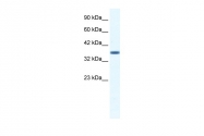 ARP36579_T100 - Annexin A3 / ANXA3