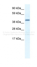 ARP36584_T100 - Annexin A7 / ANXA7