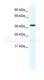 ARP36585_T100 - Annexin A7 / ANXA7