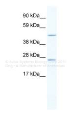 ARP36586_T100 - Annexin A11 / ANXA11