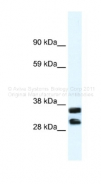 ARP36591_T100 - Annexin A13 / ANXA13