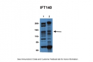 ARP36619_P050 - IFT140