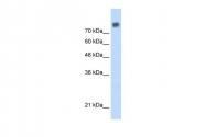 ARP36650_P050 - MCM6