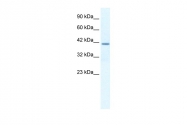 ARP36677_T100 - Osteopontin / SPP1