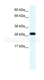 ARP36686_T100 - Annexin A4 / ANXA4