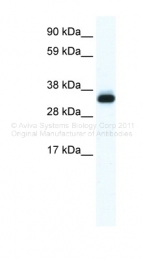 ARP36687_T100 - Annexin A5 / ANXA5