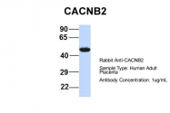 ARP36763_P050 - CACNB4