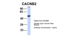 ARP36763_P050 - CACNB4