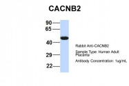 ARP36763_P050 - CACNB4