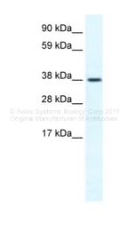 ARP36768_T100 - TRPM3 / Melastatin-2