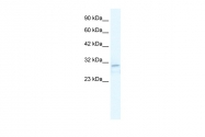 ARP36771_T100 - TRPM3 / Melastatin-2
