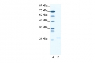 ARP36776_P050 - TRPM3 / Melastatin-2