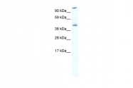 ARP36894_P050 - Heat shock factor 1 / HSF1