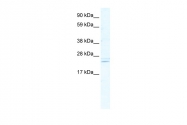 ARP36912_T100 - ASCL2