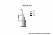 ARP36995_P050 - THRB / ERBA2