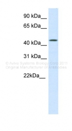 ARP37058_P050 - SMARCE1-related protein