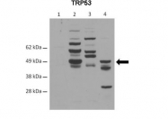 ARP37163_T100 - TP53 / p53