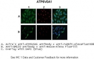 ARP37232_P050 - ATP6V0A1