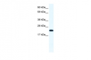 ARP37255_T100 - CITED4
