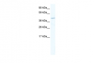 ARP37342_T100 - MEF2C