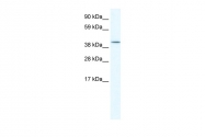 ARP37377_T100 - Islet-2 / ISL2