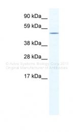ARP37471_T100 - Steroidogenic factor 1