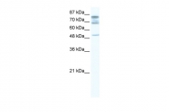 ARP37717_T100 - DDX46