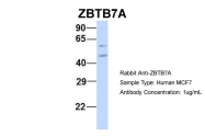 ARP37762_P050 - ZBTB7A / Pokemon