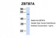 ARP37762_P050 - ZBTB7A / Pokemon