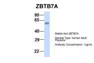 ARP37762_P050 - ZBTB7A / Pokemon