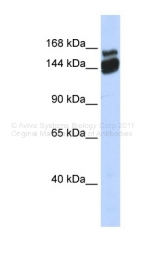 ARP37830_P050 - SCAND3