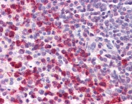 ARP37894_P050 - TGFB1