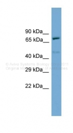 ARP37898_P050 - Tumor protein p73 (TP73)