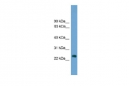 ARP37926_P050 - HES7