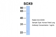 ARP37986_P050 - SOX9