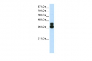 ARP38038_P050 - FOXJ1 / FKHL13