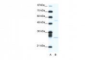 ARP38067_T100 - ATF4