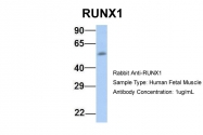 ARP38074_P050 - RUNX1