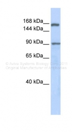 ARP38099_P050 - AFF2 / FMR2