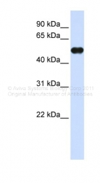 ARP38152_P050 - MNDA