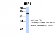 ARP38155_P050 - IRF4