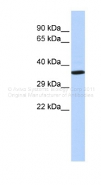 ARP38167_P050 - NKX2-2