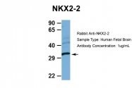 ARP38167_P050 - NKX2-2