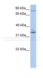 ARP38171_P050 - NPAS2