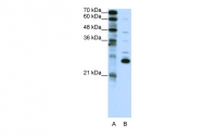 ARP38196_P050 - Recoverin