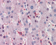 ARP38212_T100 - SIAH1