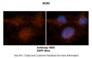 ARP38233_P050 - SOX2
