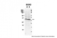 ARP38233_P050 - SOX2